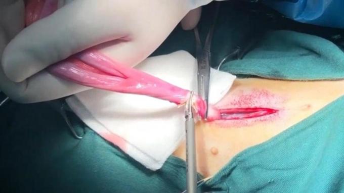 dernière affaire concernant Utilisation d'un scalpel à ultrasons pour animaux de compagnie dans la chirurgie de stérilisation et de neutralisation des chats | Chirurgie  0